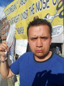 A GM worker on hunger strike in Colombia